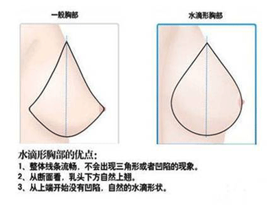 自體豐胸，變“廢”為寶！