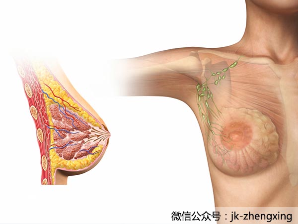 你必須知道的隆胸手術成功5大因素……