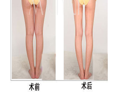 專家詳解兩種瘦腿的方法
