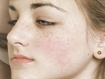 湖南122歲壽星皮膚細膩無斑 支招祛斑效果最好的方法
