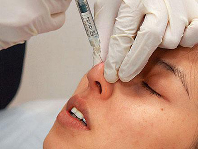 女子找美容師注射玻尿酸隆鼻 一針下去右眼失明
