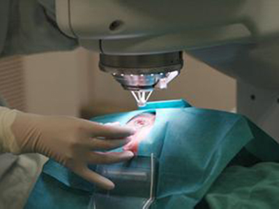 近視激光手術多少錢 近視激光手術的危害