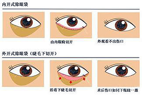 這是告別眼袋最好的方法······