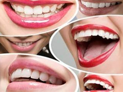 怎麼認識種植牙齒整形