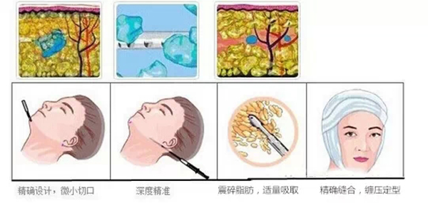 看臉的世界，專家告訴你如何擁有好臉型！