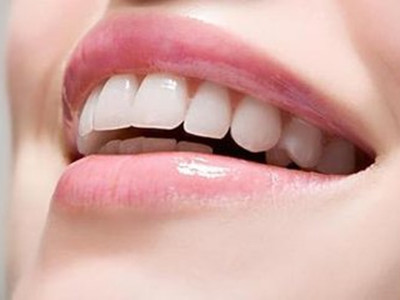 別把洗牙當美容 脫掉“髒衣服”牙齒更敏感