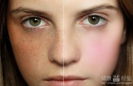臉部不同部位黃褐斑和身體內部有什麼關系