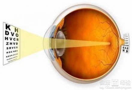 治療老年人眼睛黃斑變性方法