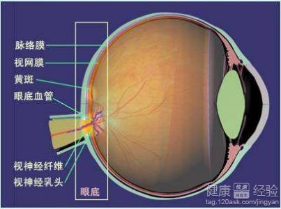 視網膜黃斑變性有什麼辦法可以避免症狀加深