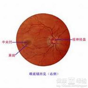 53歲,醫院確診為黃斑變性.左眼視力模糊怎麼辦