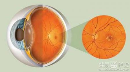 眼睛的黃斑變性藍霉素片有用嗎