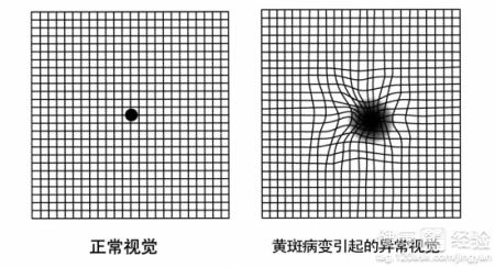 第1步