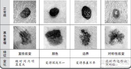 第1步