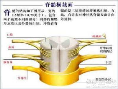 先天性隱性脊柱裂怎麼治療