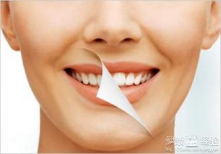 臨床上常使用的牙齒美白方法