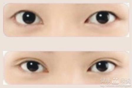 眼皮厚怎麼貼雙眼皮貼6個步驟讓你擁有一雙迷人的眼睛