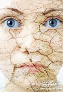 自制潤膚乳一招解決秋冬皮膚干燥脫皮的問題