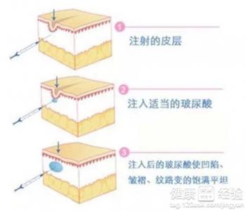 第3步