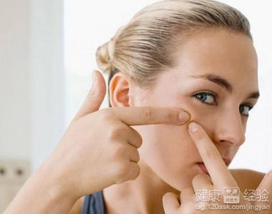 臉上有痘痘，教你幾個抗痘秘訣
