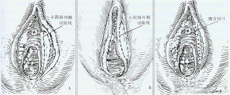 第1步