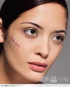 面部疤痕修復怎樣選擇適合自己的方法