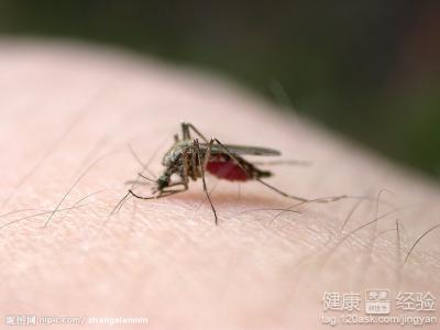怎麼去除被蚊子咬後留下的疤？