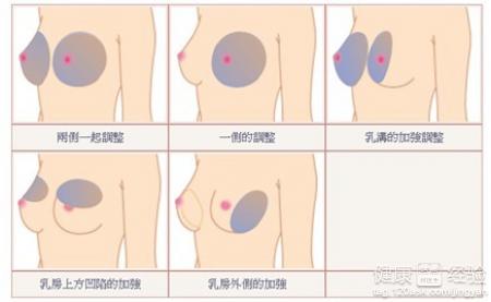 豐胸最快最有效的方法