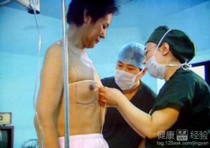 男變女手術隆胸過程