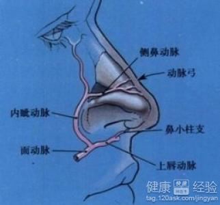 隆鼻失敗取出假體後鼻型要怎樣恢復