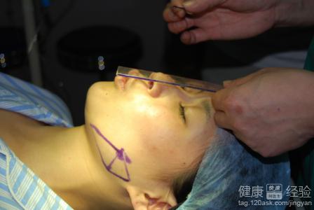 微創隆鼻整容手術前需要注意什麼?
