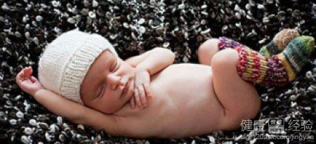 新生兒胎記怎麼治療