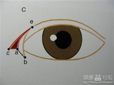 無痕開眼角會留疤嗎