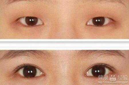 第1步