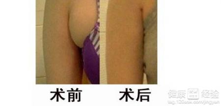 第1步