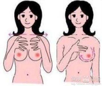 切除副乳手術步驟