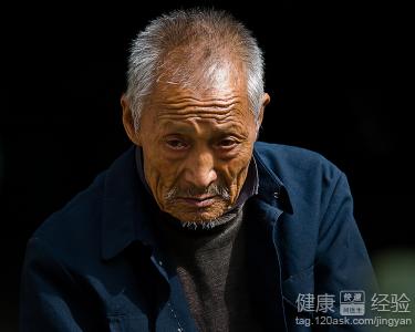 激光點痣後的紅印怎麼去?