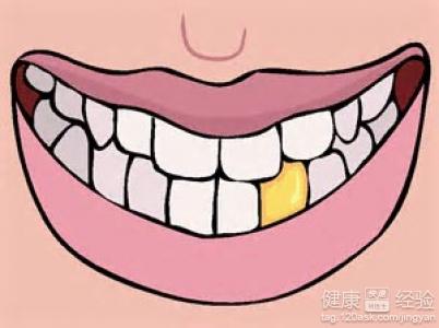 日常生活中牙齒美白的小方法